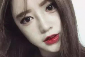 哈醫(yī)大二院整形美容科整形價(jià)格表(價(jià)目表)全新發(fā)布