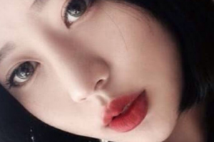 右江民族醫(yī)學(xué)院附屬醫(yī)院燒傷整形外科整形價(jià)格表(價(jià)目表)全新發(fā)布