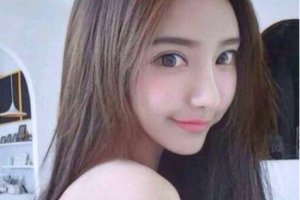 建湖縣中醫(yī)院整形價(jià)格表(價(jià)目表)一覽及醫(yī)院介紹