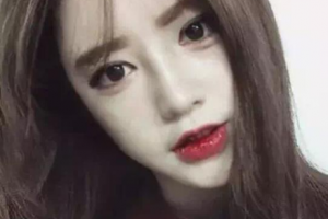 深圳西諾醫(yī)療美容醫(yī)院整形價格表(價目表)2020全新發(fā)布