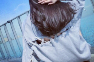 北京美聯(lián)臣美容整形醫(yī)院整形價(jià)格表(價(jià)目表)2020全新發(fā)布