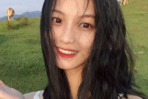 北京大學(xué)第三醫(yī)院美容整形科整形價格表(價目表)2020全新發(fā)布