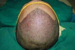 重慶騎士植發(fā)美容整形醫(yī)院整形價(jià)格表(價(jià)目表)2020全新發(fā)布