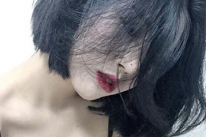 武漢協(xié)和醫(yī)院美容整形科整形價格表(價目表)2020全新發(fā)布