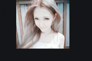 2020江西省兒童醫(yī)院整形價格表(價目表)全新發(fā)布