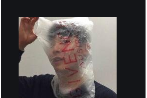 2020長(zhǎng)沙佰佳麗醫(yī)療美容門(mén)診部整形價(jià)格表(價(jià)目表)全新發(fā)布