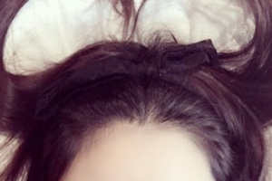 2020四川華人醫(yī)聯(lián)整形美容醫(yī)院整形價(jià)格表(價(jià)目表)全新發(fā)布