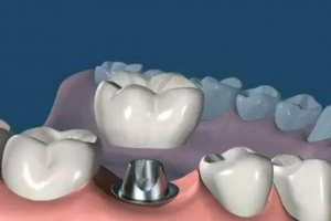 2020瀘州微笑口腔專科醫(yī)院整形價格表(價目表)全新發(fā)布