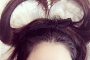 2020北京大學第三醫(yī)院整形美容外科（北醫(yī)三院）整形價格表(價目表)全新發(fā)布