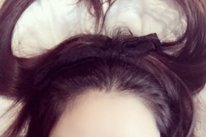 腿部吸脂了解一下！