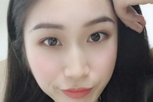 玻尿酸注射美容介紹