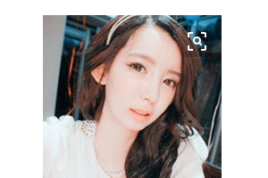 上海仁濟(jì)醫(yī)院整形外科陸毅整形價格表附肋軟骨隆鼻案例展示