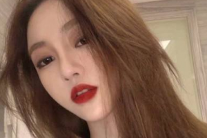 北京張海明整形美容門診部李輝整形價格表附熱瑪吉案例展示