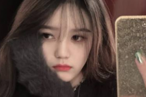 北京AJ醫(yī)療美容診所王秀川整形價格表附手臂吸脂案例展示