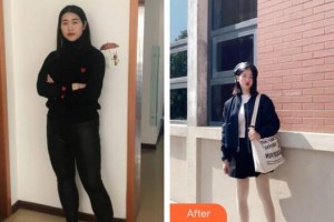 廣州醫(yī)學(xué)院第二附屬醫(yī)院整形美容中心張梅英整形價(jià)格表附美體塑形案例展示