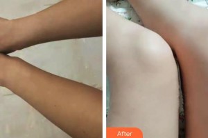 上海天大醫(yī)療美容醫(yī)院邱陽整形價格表附注射美白案例展示