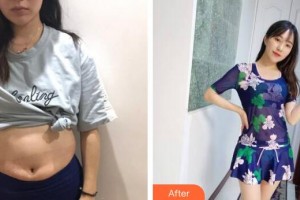 廣州遠(yuǎn)東美容醫(yī)院袁欣整形價(jià)格表附美體塑形案例展示