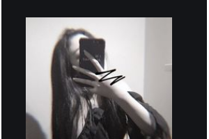 南京華美美容醫(yī)院張曉剛整形價(jià)格表附肋軟骨隆鼻案例展示