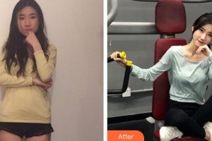 三門峽常亮醫(yī)療美容診所鄭東海整形價(jià)格表附玻尿酸導(dǎo)入案例展示