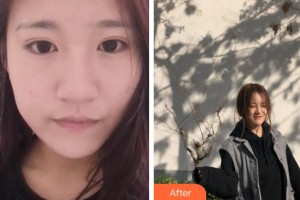 上海玫瑰醫(yī)療美容醫(yī)院吳曉麗整形價格表附無針水光案例展示