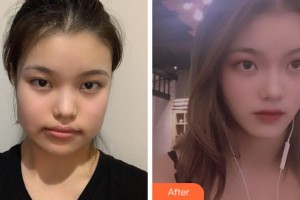 上海華美整形美容醫(yī)院晉孝敏整形價(jià)格表附自然V臉型案例展示