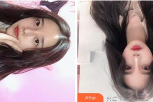 上海玫瑰醫(yī)療美容醫(yī)院刁慶華整形價格表附微針美膚案例展示