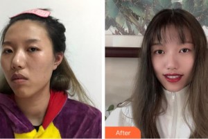 上海玫瑰醫(yī)療美容醫(yī)院汪梅主診醫(yī)師整形價格表附白瓷案例展示