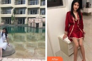 廣州軍頤醫(yī)院整形美容中心崔菲菲整形價(jià)格表附白瓷娃娃案例展示