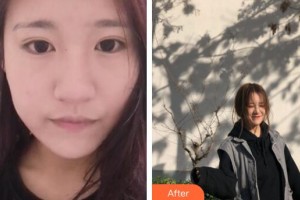 廣州軍頤醫(yī)院整形美容中心石建薇整形價(jià)格表附無(wú)針?biāo)獍咐故?>
</a>
<h3 class=