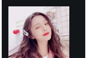 南京友誼整形外科醫(yī)院盧相勛整形價格表附硅膠墊下巴案例展示