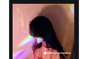 南京康美美容醫(yī)院王健整形價格表附假體墊眉弓案例展示