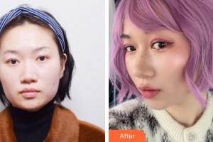 上海藝星醫(yī)療美容醫(yī)院姜敏赫整形價(jià)格表附埋線雙眼皮+去脂案例展示