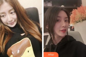 廣州軍區(qū)總醫(yī)院全軍激光整形美容中心吳燕虹整形價(jià)格表附鼻修復(fù)+鼻部手術(shù)案例展示