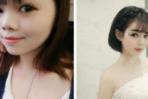 南京東美整形美容醫(yī)院嚴(yán)東玲整形價格表附無針?biāo)獍咐故?>
</a>
<h3 class=