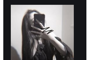 南京維多利亞整形美容醫(yī)院Eric.Redd整形價格表附V-LINE瓜子瘦臉手術(shù)案例展示