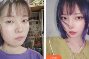 上?，旣愥t(yī)院整形美容中心李云天主診醫(yī)師整形價格表附皮膚清潔補水嫩膚案例展示