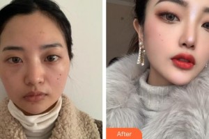 上海樂天整形外科門診部金道演整形價(jià)格表附顴骨+下頜角案例展示