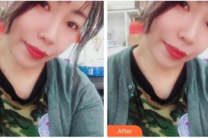 上海新形象整形外科門診部劉岱良整形價格表附臉頰面部填充案例展示