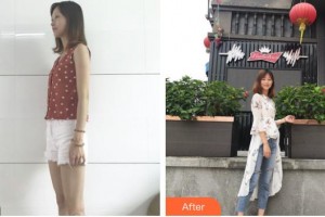 上海市第七人民醫(yī)院燒傷整形科吳志宏整形價(jià)格表附燙傷疤痕案例展示