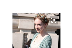 南京美梯醫(yī)療美容醫(yī)院整形價格表附埋線提升案例展示