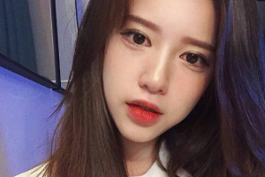 南京連天美醫(yī)療美容醫(yī)院曹旭整形價格表附切開雙眼皮案例展示