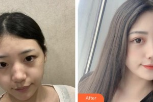 上海保加醫(yī)療美容門診部張英整形價格表附激光祛斑案例展示