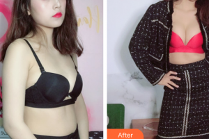 廣州韓妃醫(yī)學(xué)美容醫(yī)院黃招標(biāo)整形價(jià)格表附濃縮豐胸案例展示