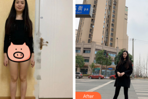 廣州博研醫(yī)療美容門診部顏玲整形價格表附吸脂瘦大腿案例展示