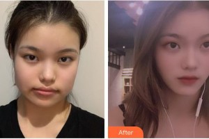 上海百達麗醫(yī)療美容醫(yī)院王維整形價格表附自然V臉型案例展示