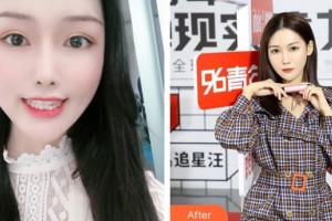 上海百達麗醫(yī)療美容醫(yī)院董曉瑾整形價格表附隱形矯正案例展示