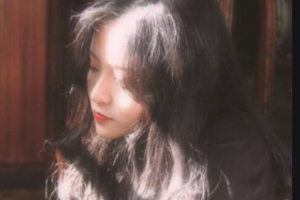 南京繆斯女神醫(yī)療美容診所許更宇整形價(jià)格表附假體墊眉弓案例展示