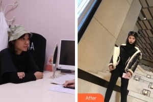 上海歐華醫(yī)療美容門診部樸麗華整形價(jià)格表附皮膚管理案例展示