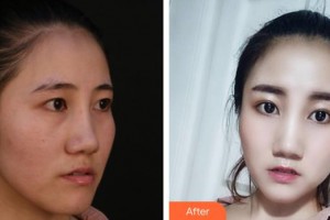 上海伊萊美醫(yī)療美容醫(yī)院任建新整形價(jià)格表附皮膚管理案例展示