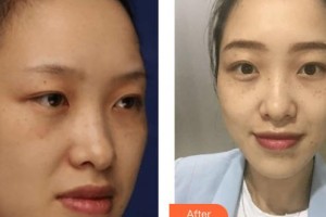 上海復(fù)麗醫(yī)療美容門(mén)診部林繡諭整形價(jià)格表附激光祛斑案例展示